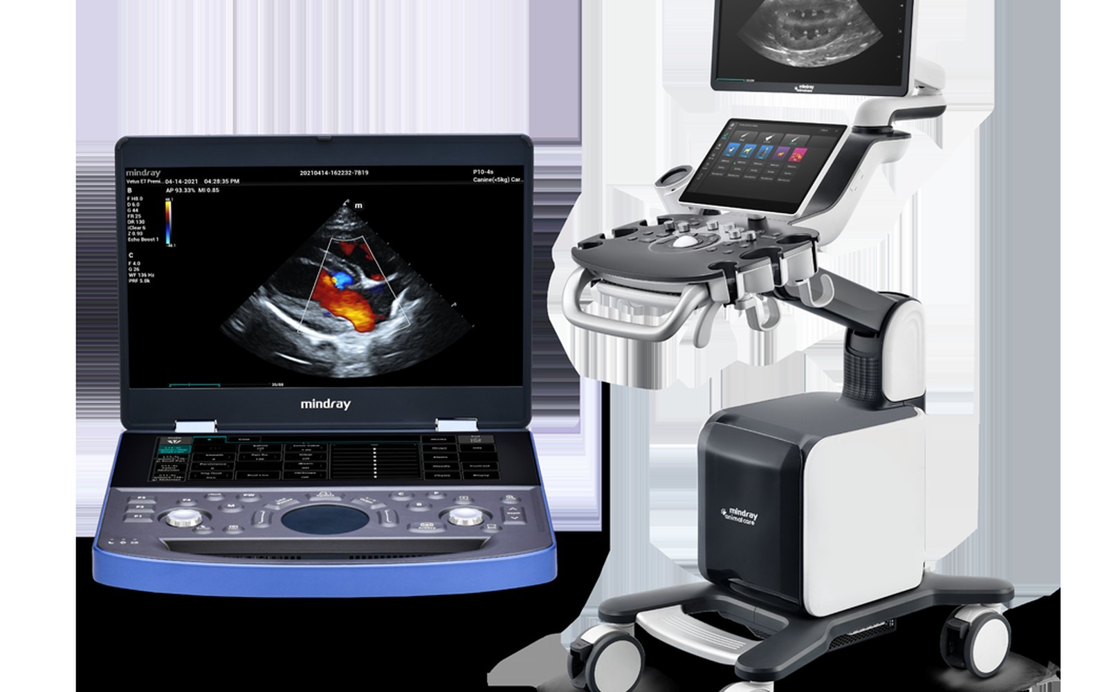 Cardiac Ultrasound Machines