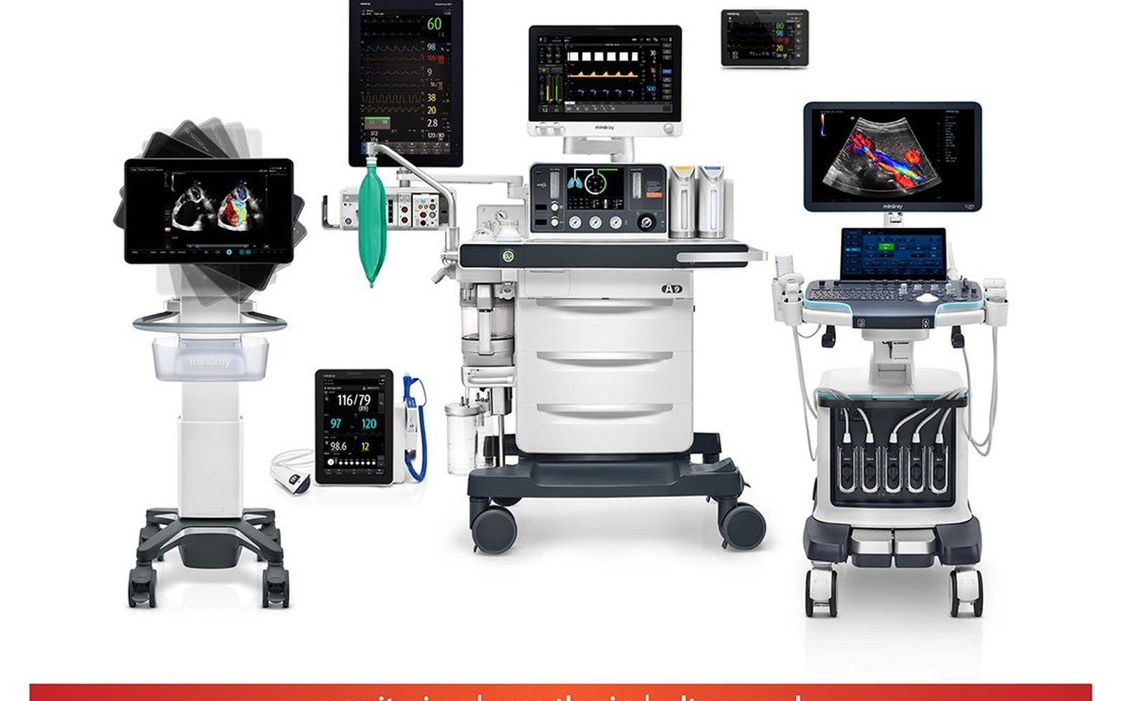 Fetal Monitoring Ultrasound