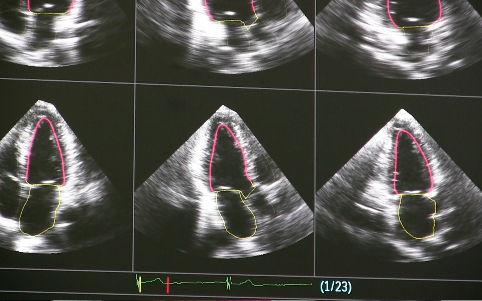 Mid Range Ultrasound Systems