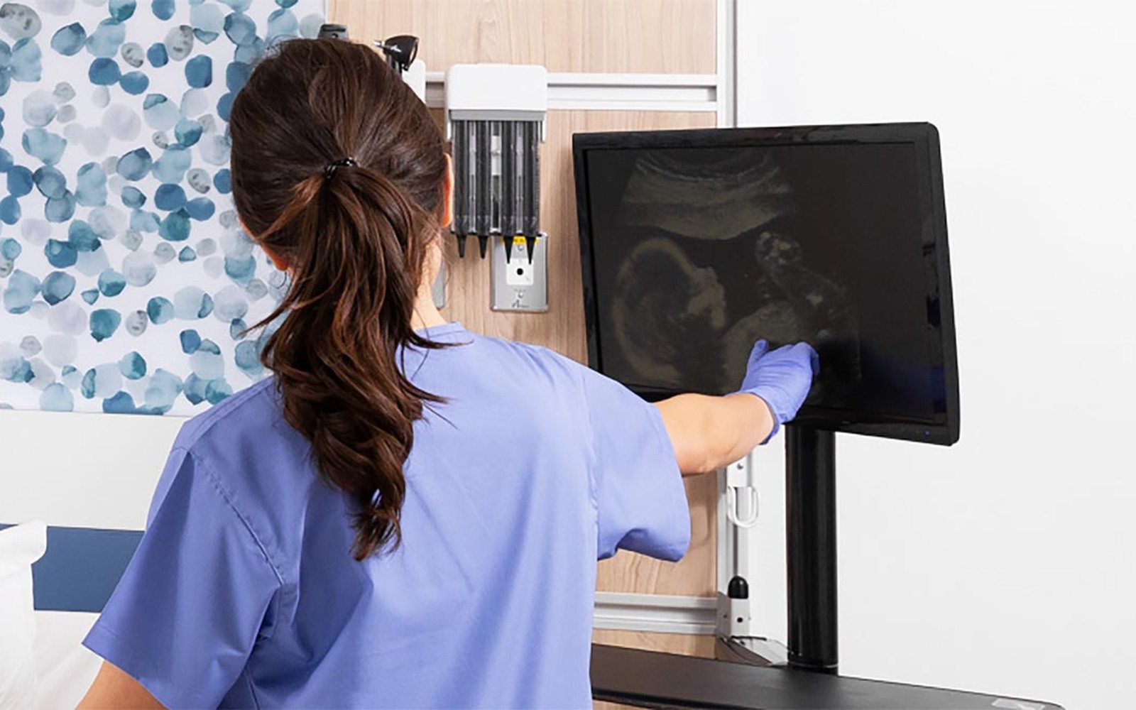 Ultrasound Workstations & Carts