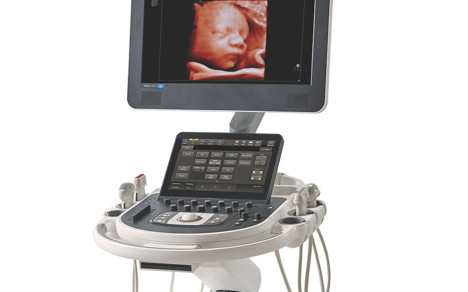 Philips Lumify Financing