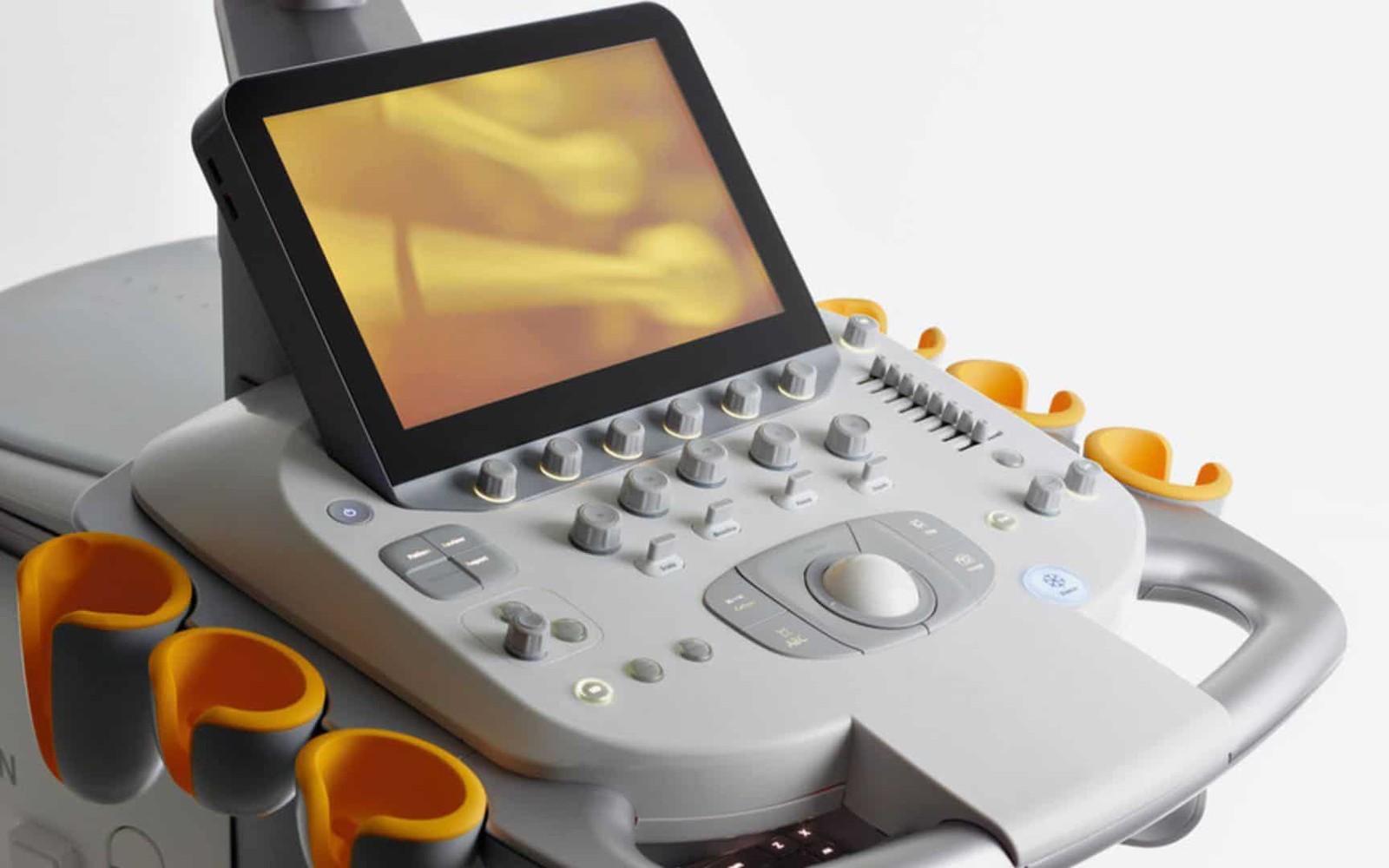 Siemens Acuson S3000 Financing